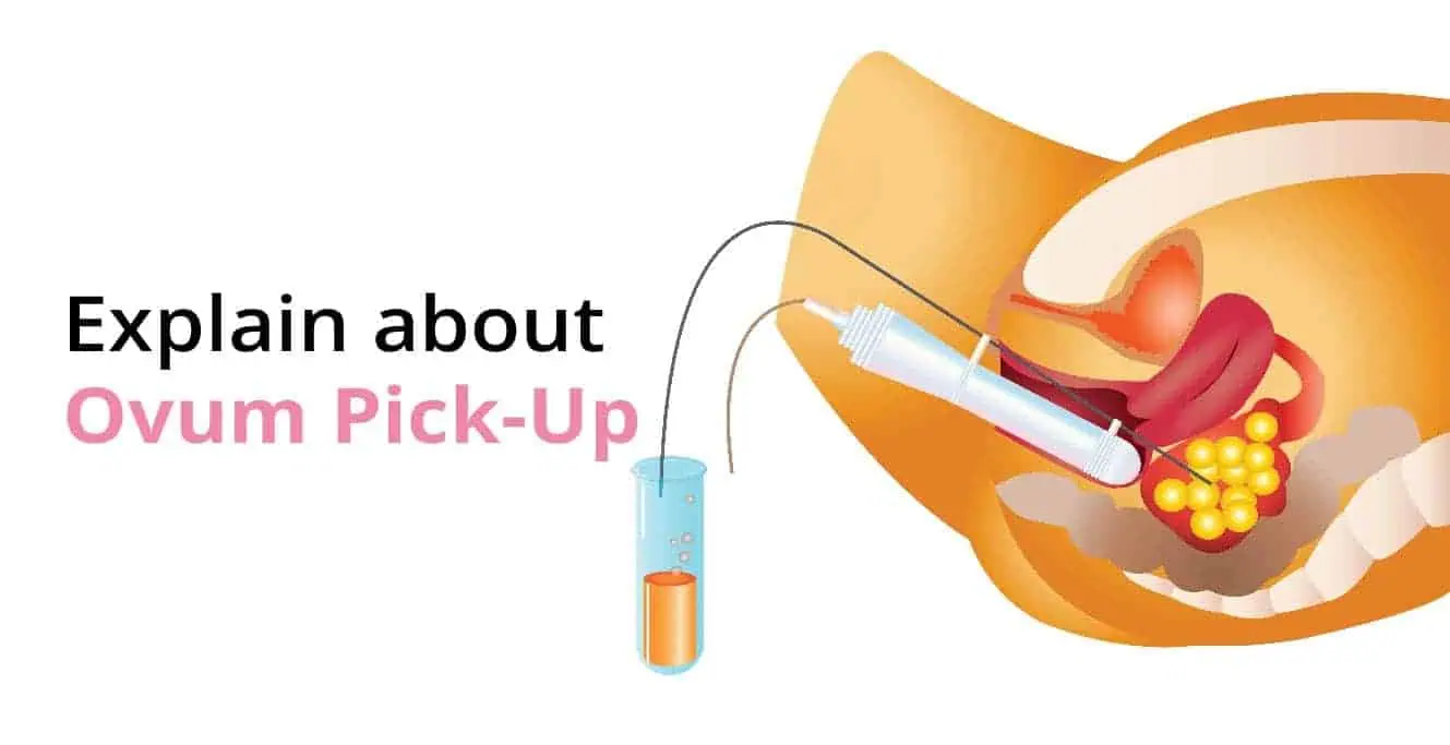 ICSI Treatment and Ovum Pickup Room in India – Cost, Procedure & Success Rate